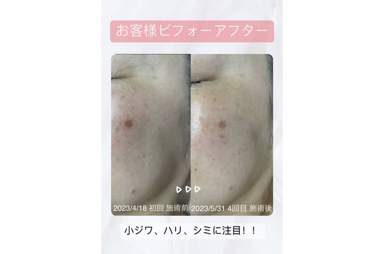 S__42483715